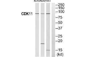 Western blot analysis of extracts from HUVEC cells, HepG2 cells and CoLo cells, using CDK11 antibody. (CDK11 antibody  (Internal Region))