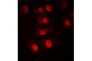Immunofluorescent analysis of TCFL4 staining in LOVO cells. (MLX antibody  (Center))