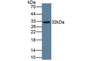 Western blot analysis of Human Lung Tissue, using IL33 antibody and HRP-conjugated Rabbit Anti-Mouse antibody ( (IL-33 antibody  (AA 112-270))