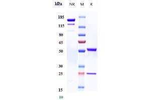 Anti-ACVR2B Reference Antibody (bimagrumab) on SDS-PAGE under reducing (R) condition. (Recombinant ACVR2B (Bimagrumab Biosimilar) antibody)