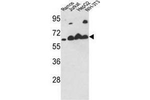 Image no. 1 for anti-Calreticulin (CALR) (Middle Region) antibody (ABIN452803) (Calreticulin antibody  (Middle Region))