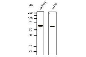 Anti-myc tag Ab at 1/1,000 dilution, 293 cells transfected With myc-mCherry (red fluorescent protein), rabbit polyclonal to goat lµg (HRP) at 1/10,000 dilution, (CHM antibody  (AA 1-80))