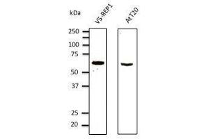 Anti-myc tag Ab at 1/1,000 dilution, 293 cells transfected With myc-mCherry (red fluorescent protein), rabbit polyclonal to goat lµg (HRP) at 1/10,000 dilution, (CHM antibody  (AA 1-80))