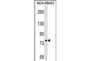 PNPT1 Antibody (Center) (ABIN1538242 and ABIN2849157) western blot analysis in MDA-M cell line lysates (35 μg/lane). (PNPT1 antibody  (AA 284-311))