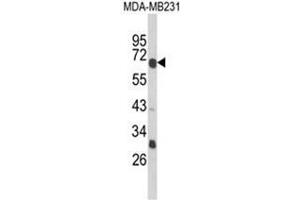 Western blot analysis of GIPR Antibody (Center) in MDA-MB231 cell line lysates (35ug/lane).
