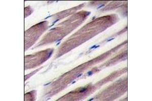 Formalin-fixed and paraffin-embedded human skeletal muscle tissue reacted with LATS2 antibody (Center), which was peroxidase-conjugated to the secondary antibody, followed by DAB staining. (LATS2 antibody  (Middle Region))