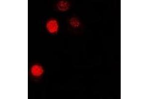 Immunofluorescent analysis of MATH-1 staining in U2OS cells. (ATOH1 antibody)