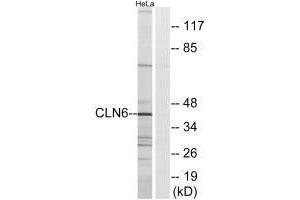 Western blot analysis of extracts from HeLa cells, using CLN6 antibody. (CLN6 antibody)