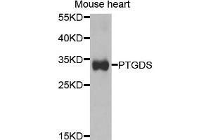 Western blot analysis of extracts of mouse heart, using PTGDS antibody.