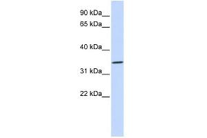 WB Suggested Anti-RHCE Antibody Titration:  0. (RHCE antibody  (N-Term))