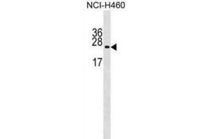 Western Blotting (WB) image for anti-Ribosomal Protein L10a (RPL10A) antibody (ABIN2999207)