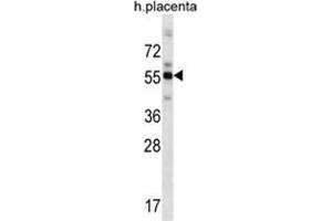 ZBTB8B Antibody (C-term) (AP54617PU-N ) western blot analysis in human placenta tissue lysates (35 µg/lane). (ZBTB8B antibody  (C-Term))