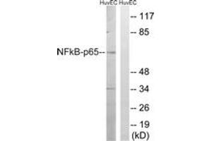 Western blot analysis of extracts from HuvEc cells, treated with EPO 20U/ml 15', using NF-kappaB p65 (Ab-281) Antibody. (NF-kB p65 antibody  (AA 247-296))
