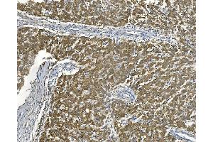 IHC analysis of AKR7A2 using anti-AKR7A2 antibody (ABIN7601157).