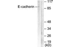 Western blot analysis of extracts from 293 cells, using E-cadherin Antibody. (E-cadherin antibody  (AA 1-50))