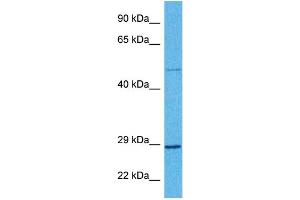 Host:  Rabbit  Target Name:  BDNF  Sample Tissue:  Human Ovary Tumor  Antibody Dilution:  1ug/ml (BDNF antibody  (Middle Region))