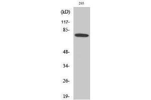 Western Blotting (WB) image for anti-Bruton Agammaglobulinemia tyrosine Kinase (BTK) (Ser189) antibody (ABIN3183568) (BTK antibody  (Ser189))