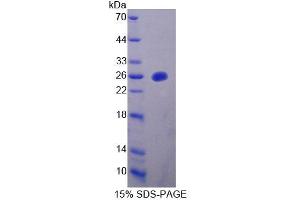 SDS-PAGE analysis of Mouse MTUS1 Protein. (MTUS1 Protein)