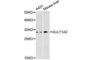 Western blot analysis of extracts of various cell lines, using SULT1A2 antibody. (SULT1A2 antibody)