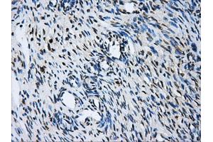 Immunohistochemical staining of paraffin-embedded liver tissue using anti-GBE1 mouse monoclonal antibody.
