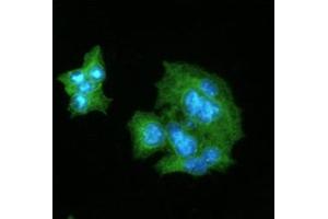 Immunofluorescence (IF) image for anti-C-Reactive Protein (CRP) (AA 19-224) antibody (ABIN165390)