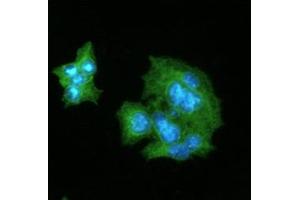 ICC/IF analysis of CRP in HepG2 cells line, stained with DAPI (Blue) for nucleus staining and monoclonal anti-human CRP antibody (1:100) with goat anti-mouse IgG-Alexa fluor 488 conjugate (Green). (CRP antibody)