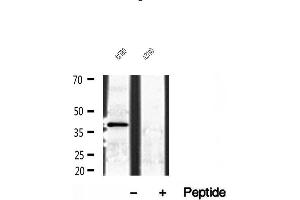 Western blot analysis of extracts of A2780 cells, using NDE1 antibody. (NDE1 antibody  (N-Term))