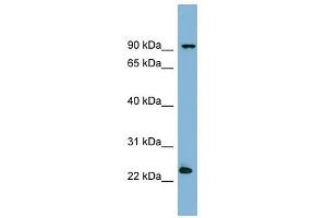 VPS29 antibody used at 1 ug/ml to detect target protein. (VPS29 antibody)