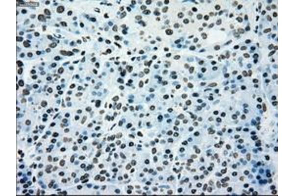 Melanoma gp100 antibody
