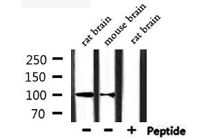 Western blot analysis of extracts from rat brain, mouse brain, using CHSY3 Antibody. (CHSY3 antibody  (N-Term))