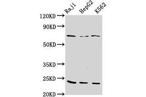 Western Blot Positive WB detected in: Raji whole cell lysate, HepG2 whole cell lysate, K562 whole cell lysate All lanes: PSMB9 antibody at 10 μg/mL Secondary Goat polyclonal to rabbit IgG at 1/50000 dilution Predicted band size: 24, 23 kDa Observed band size: 24 kDa (PSMB9 antibody  (AA 21-219))