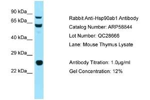 Western Blotting (WB) image for anti-Heat Shock Protein 90kDa alpha (Cytosolic), Class B Member 1 (HSP90AB1) (N-Term) antibody (ABIN970914) (HSP90AB1 antibody  (N-Term))