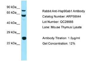 Western Blotting (WB) image for anti-Heat Shock Protein 90kDa alpha (Cytosolic), Class B Member 1 (HSP90AB1) (N-Term) antibody (ABIN2787849) (HSP90AB1 antibody  (N-Term))