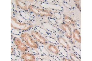 Used in DAB staining on fromalin fixed paraffin- embedded Kidney tissue (IFNA antibody  (AA 24-189))