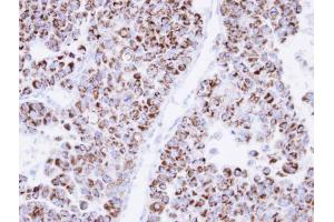 IHC-P Image Immunohistochemical analysis of paraffin-embedded OV90 xenograft, using ECH1, antibody at 1:500 dilution. (ECHS1 antibody)