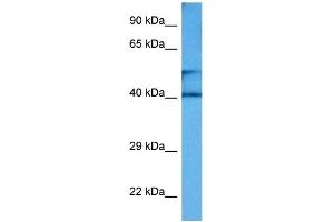 Host:  Mouse  Target Name:  CKM  Sample Tissue:  Mouse Small Intestine  Antibody Dilution:  1ug/ml (CKM antibody  (Middle Region))