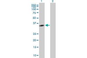 EXOSC7 antibody  (AA 1-291)