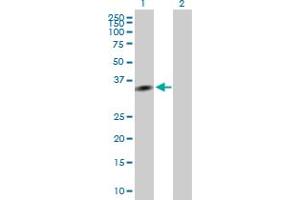 Western Blot analysis of EXOSC7 expression in transfected 293T cell line by EXOSC7 MaxPab polyclonal antibody. (EXOSC7 antibody  (AA 1-291))