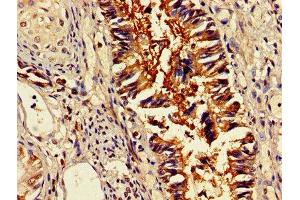 IHC image of ABIN7159465 diluted at 1:400 and staining in paraffin-embedded human lung tissue performed on a Leica BondTM system. (OMA1 antibody  (AA 22-194))