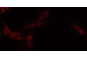ABIN6274597 staining A549 by IF/ICC. (Cadherin-16 antibody  (C-Term))