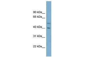 B4GALT2 antibody used at 1 ug/ml to detect target protein.