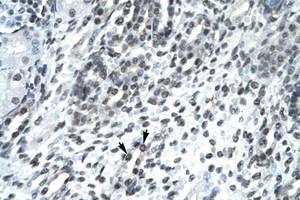 Image no. 2 for anti-Sirtuin 5 (SIRT5) (AA 184-233) antibody (ABIN202189)