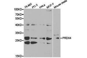 Western Blotting (WB) image for anti-Peroxiredoxin 4 (PRDX4) antibody (ABIN1874258) (Peroxiredoxin 4 antibody)