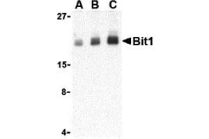Western Blotting (WB) image for anti-Peptidyl-tRNA Hydrolase 2 (PTRH2) (Middle Region) antibody (ABIN1030890) (PTRH2 antibody  (Middle Region))