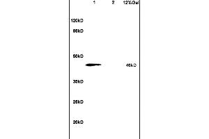 L1 rat brain lysates L2 human colon carcinoma lysates probed with Anti PHKG2 Polyclonal Antibody, Unconjugated (ABIN708326) at 1:200 in 4 °C. (PHKG2 antibody  (AA 81-180))