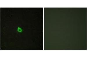 Immunofluorescence analysis of HepG2 cells, using RECK Antibody. (RECK antibody  (AA 21-70))