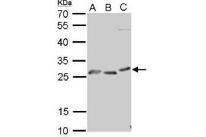 WB Image PRP antibody detects PRNP protein by Western blot analysis.