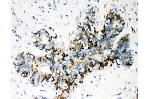 Immunohistochemistry (IHC) image for anti-ATP-Binding Cassette, Sub-Family B (MDR/TAP), Member 4 (ABCB4) (AA 601-720) antibody (ABIN3028483)