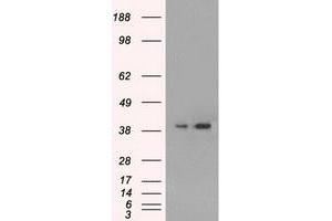 HEK293T cells were transfected with the pCMV6-ENTRY control (Left lane) or pCMV6-ENTRY MAPK1 (Right lane) cDNA for 48 hrs and lysed. (ERK2 antibody)