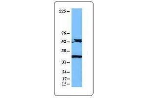 Western Blotting (WB) image for anti-Caspase 8 (CASP8) antibody (ABIN2666061) (Caspase 8 antibody)